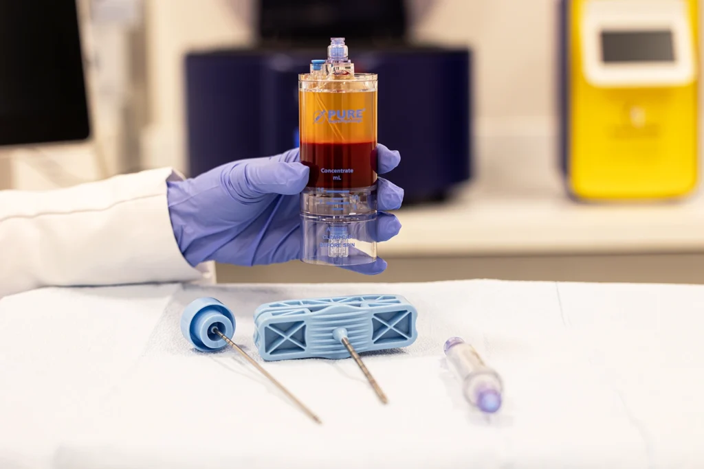PRP Eficiente: A Importância do Volume de Sangue Coletado