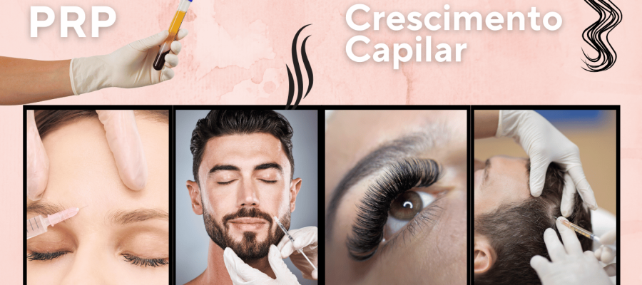 Crescimento Capilar com PRP: Sobrancelhas, Barba e Cílios