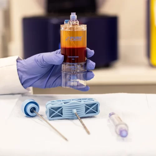 PRP Eficiente: A Importância do Volume de Sangue Coletado