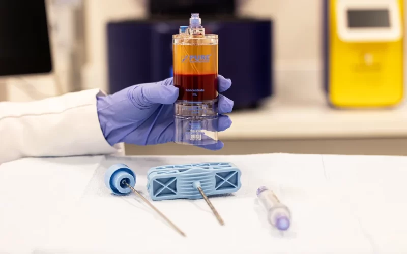 PRP Eficiente: A Importância do Volume de Sangue Coletado