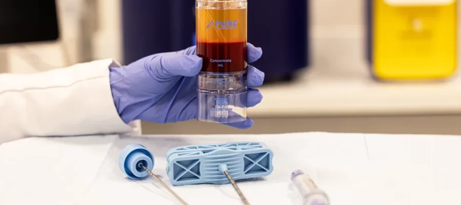 PRP Eficiente: A Importância do Volume de Sangue Coletado